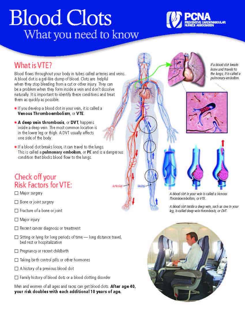VTE and Blood Clots Cover VTE and Blood Clots Cover