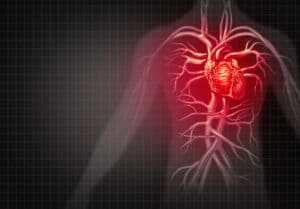 Heart attack and chest pain medical cardiovascular disease as an illness of a human circulation organ in a 3D illustration style.